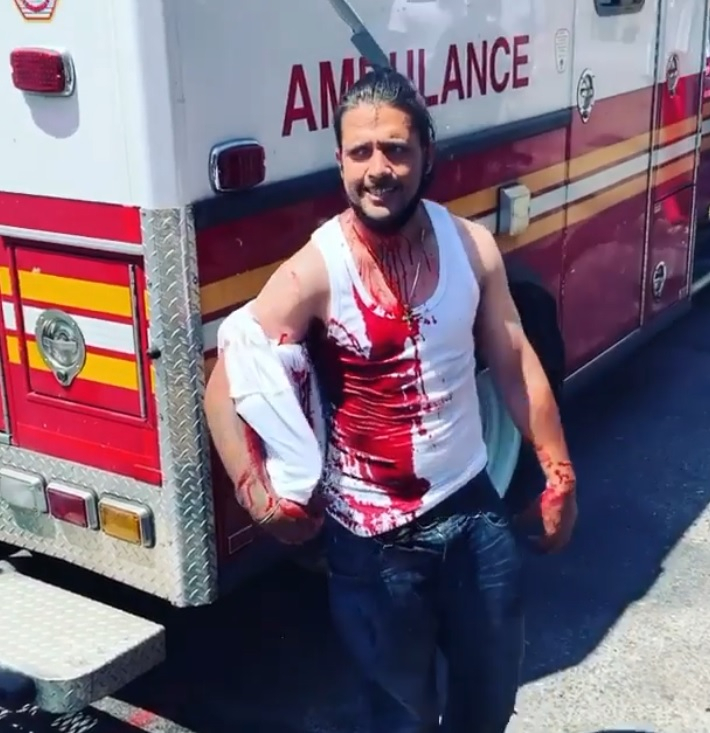 NYC man stabbed in head