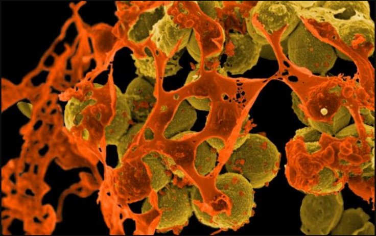 Methicillin-resistant Staphylococcus aureus (MRSA) Bacteria Methicillin-resistant Staphylococcus aureus (MRSA) Bacteria