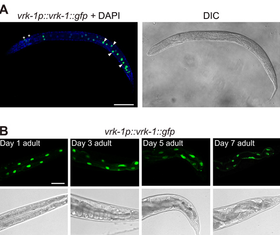 VRK-1 is a nuclear protein that increases worm life span