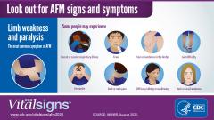AFM symptoms
