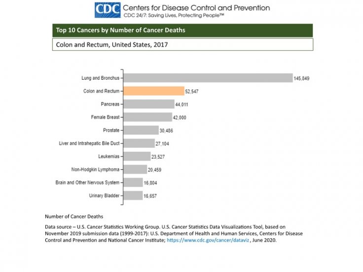 Colon Cancer Colon Cancer