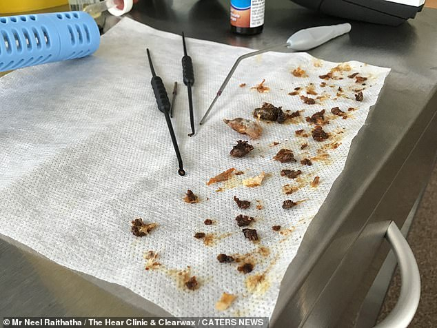 ear wax ear wax