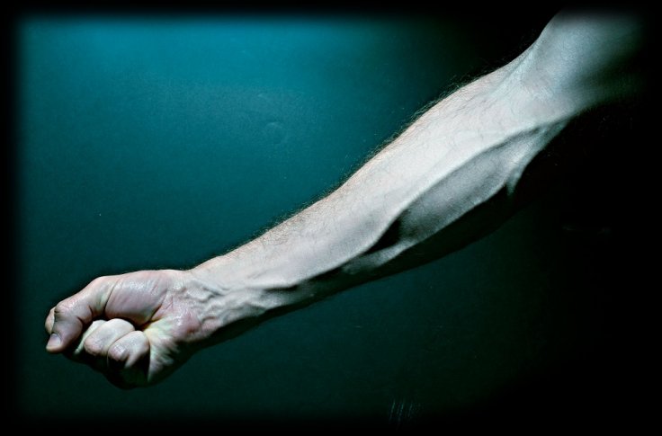 arm arm