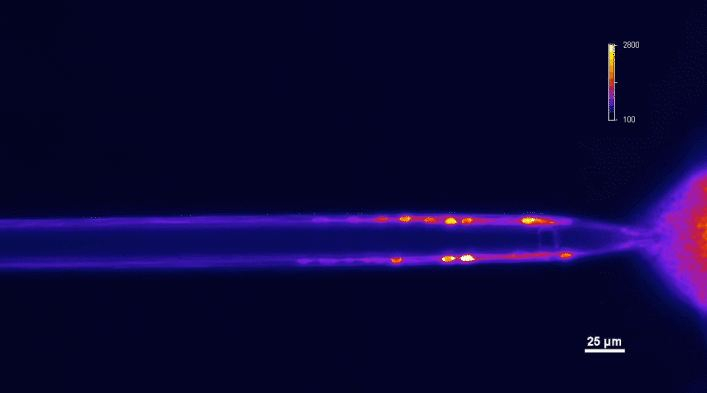 Neuron's In Mosquitoes Sting