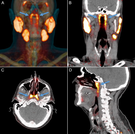 New Salivary Glands