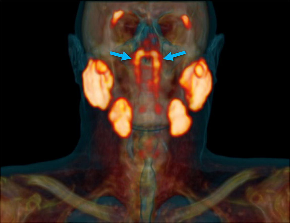 Scientists Accidentally Discover Two New Glands Right In The Middle of