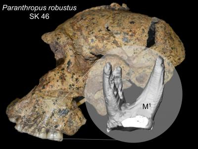 Paranthropus robustus