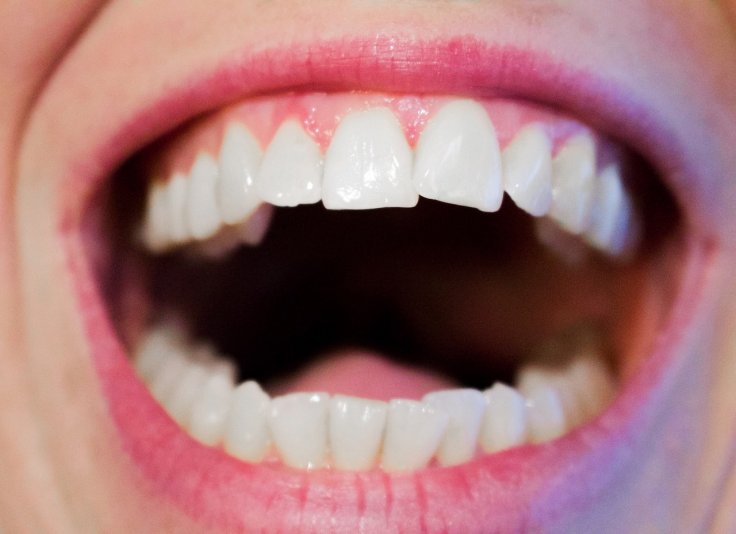 Human Teeth Human Teeth