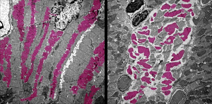 Heart muscle cells