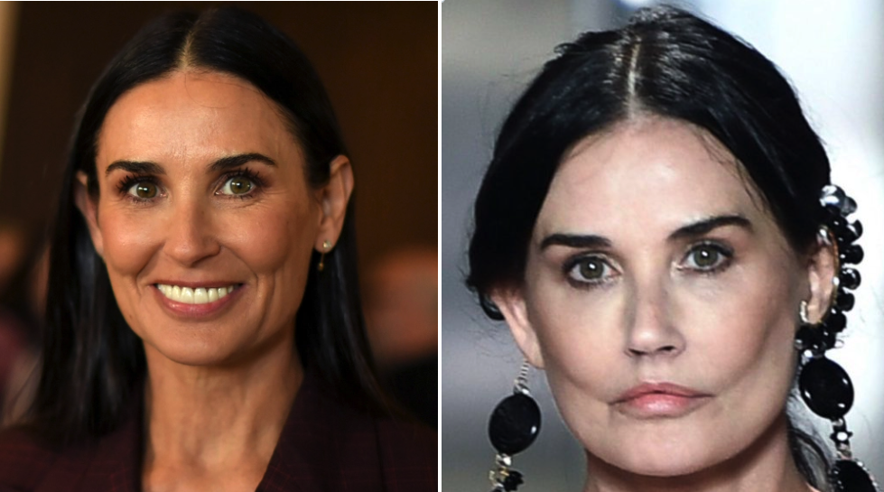 Demi Moore Fuels 'Botched Plastic Surgery' Speculation