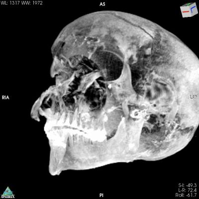 3D Virtual Reality image of the pharaohs skull 3D Virtual Reality image of the pharaohs skull