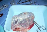 Human Placenta Organs