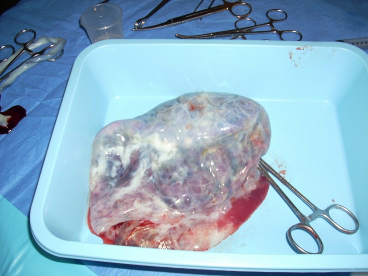 Human Placenta Organs