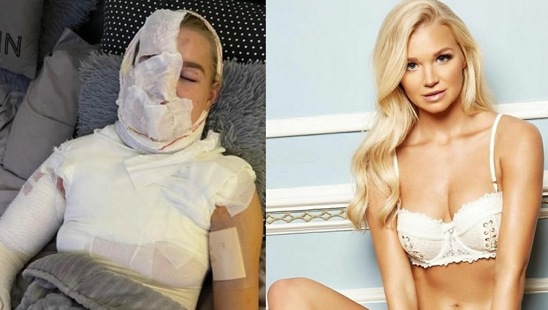 Who Is Abbie Quinnen Aj Pritchard Girlfriend Suffers 3rd Degree Burns In Instagram Video Stunt