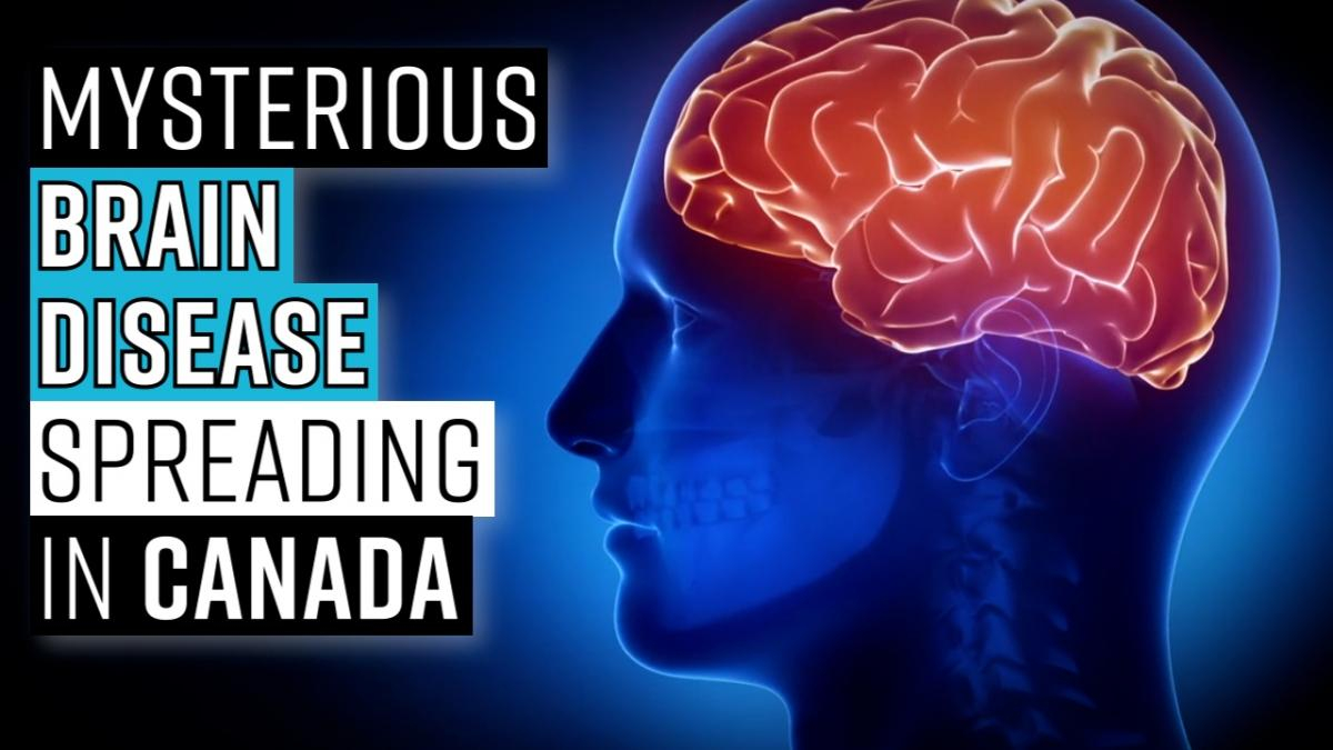 mysterious-brain-disease-spreading-in-canada