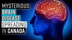 mysterious-brain-disease-spreading-in-canada
