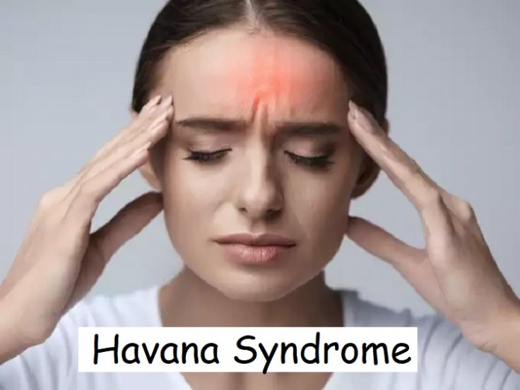 What is Havana Syndrome