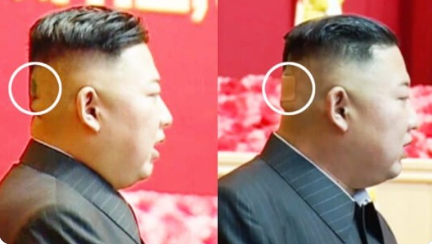 Kim Jong Un