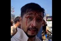 Australian man beaten by Taliban