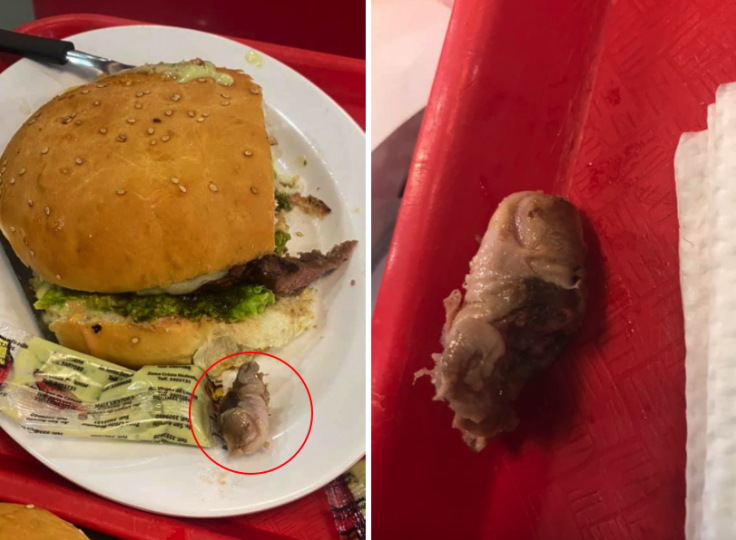woman finds rotten finger in burger