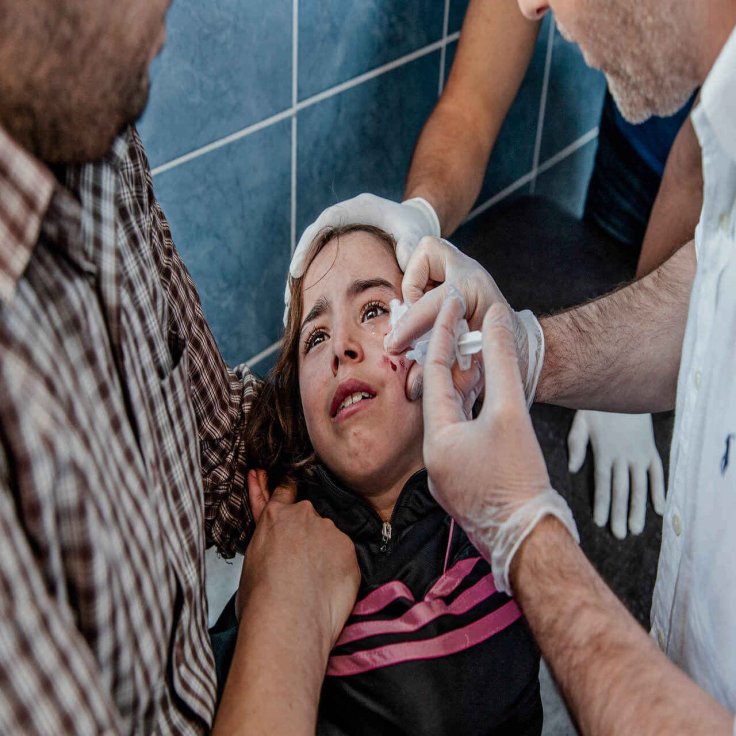 Leishmaniasis Leishmaniasis