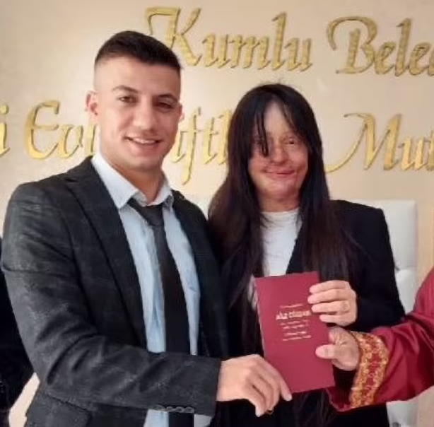 Berfin Ozek (right) Casim Ozan Celtik (left) in their marriage ceremony Berfin Ozek (right) Casim Ozan Celtik (left) in their marriage ceremony