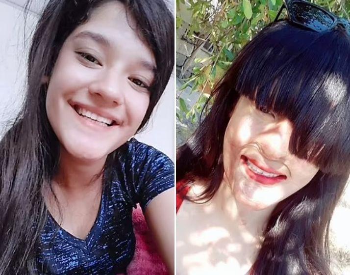 Berfin Ozek before (L) and after the attack (R) Berfin Ozek before (L) and after the attack (R)