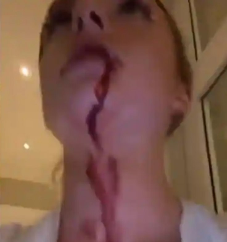 Rape allegation Rape allegation