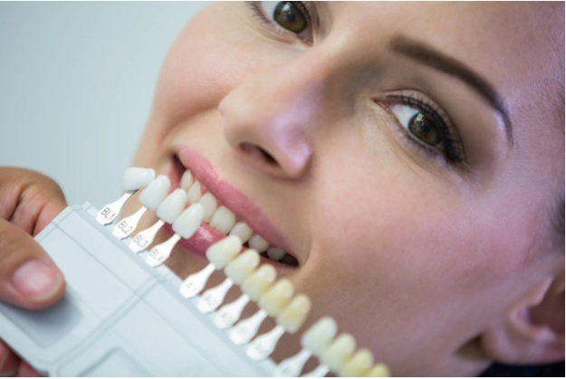 Porcelain Veneers Porcelain Veneers