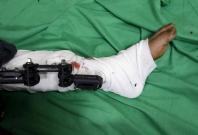 Picture for representation Picture for representation