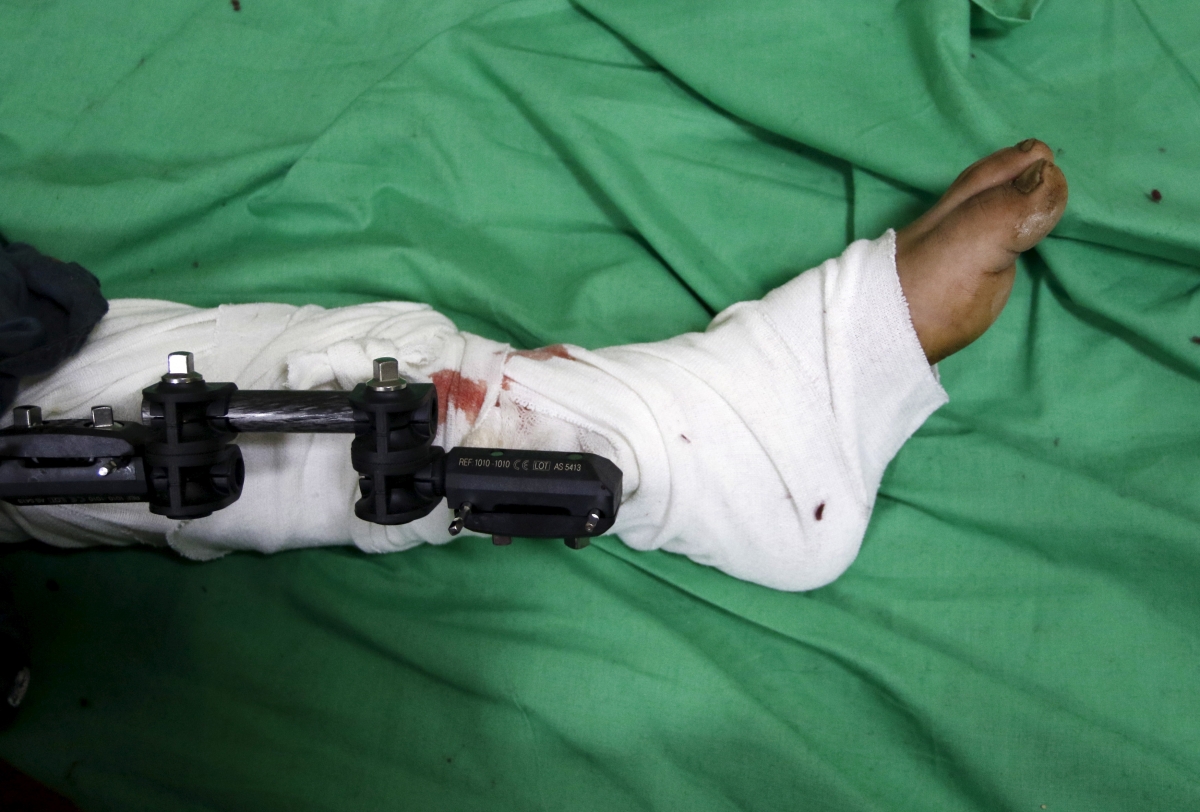 Picture for representation