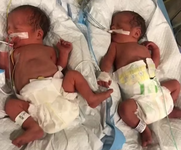 The babies weigh around 4 pounds each and are facing health complications including having trouble breathing