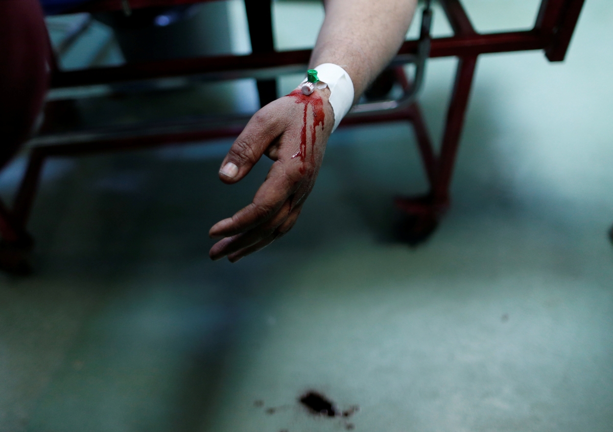 Picture for representation