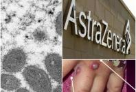 A false claim suggests the AstraZeneca COVID-19 vaccine causes Monkeypox infections.