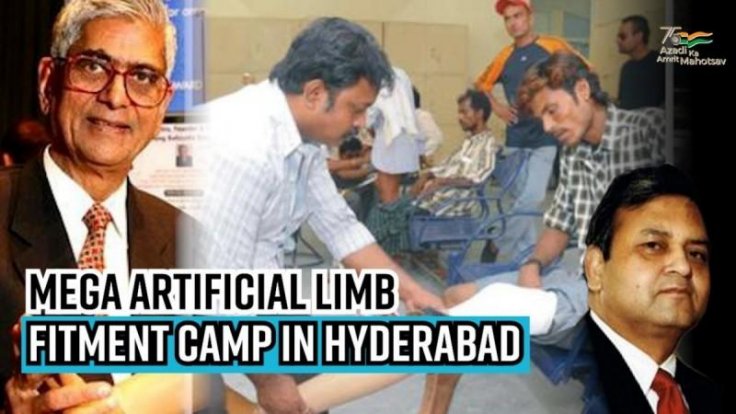 Mega artificial limb fitment camp in Hyd; Jaipur Foot USA set to create history on I-Day Mega artificial limb fitment camp in Hyd; Jaipur Foot USA set to create history on I-Day
