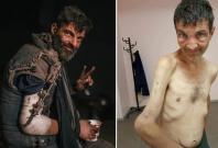 Before and after pics of Ukrainian soldier Mykhailo Dianov captured by Russia