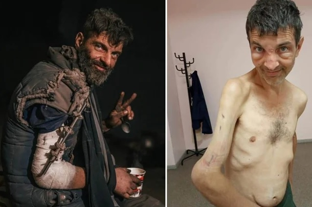 Before and after pics of Ukrainian soldier Mykhailo Dianov captured by Russia