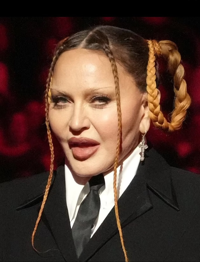 Madonna Slams Critics Who Called Her Appearance 'Unrecognizable' At ...