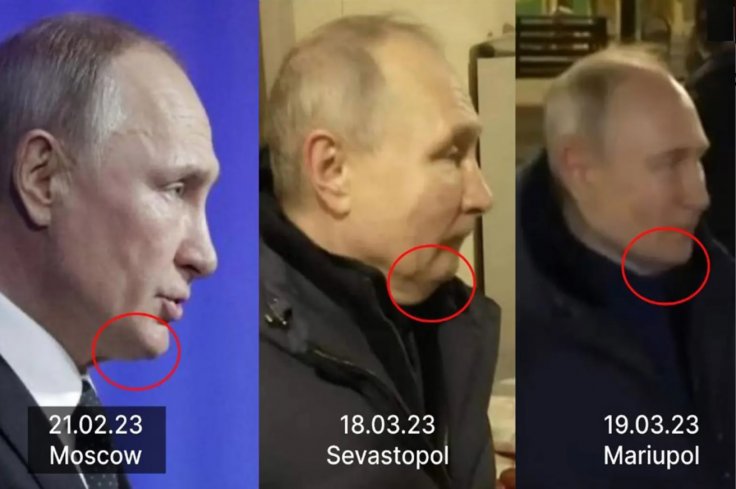 Putin chin