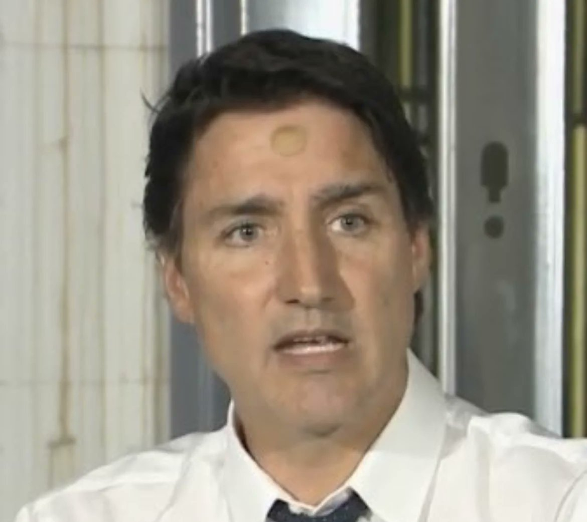 Victim Of Domestic Abuse? Speculations After Justin Trudeau Appears ...