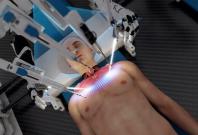 Head transplant system Head transplant system