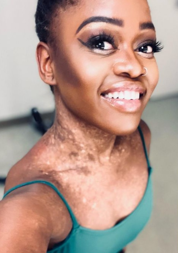 Michaela DePrince