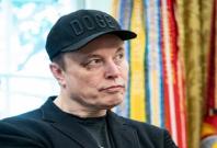 Elon Musk black eye Elon Musk black eye