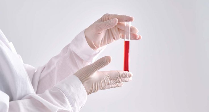 Gwada Negative blood group reference image
