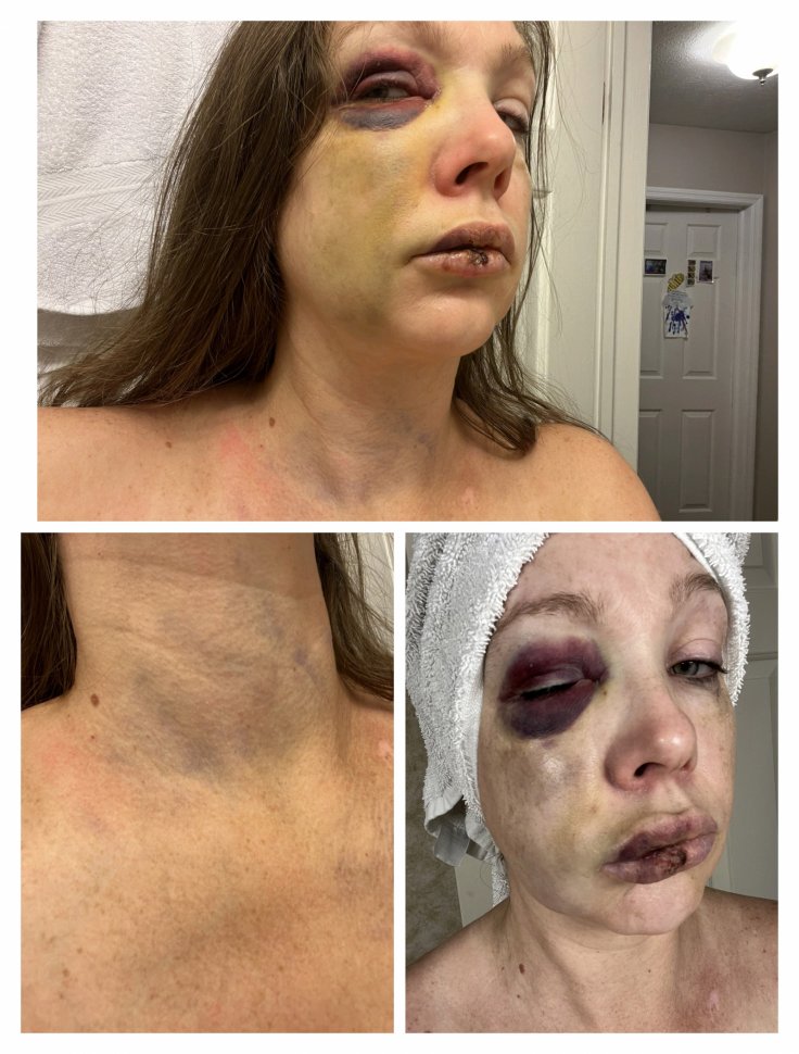 Cincinnati Mass Brawl Victim