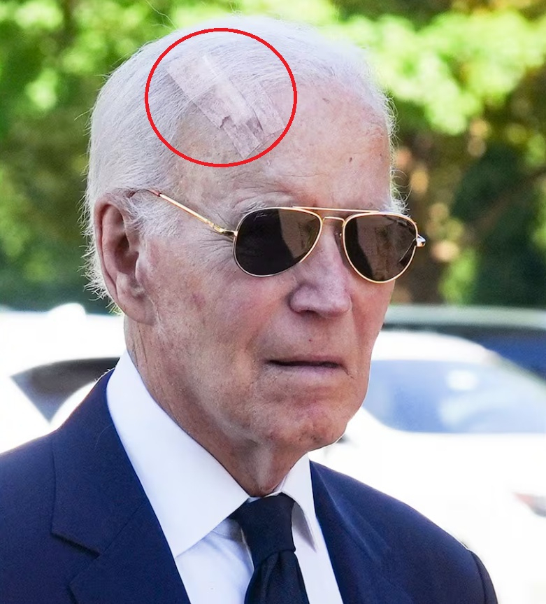 Biden head cut