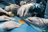 Gastric Bypass Surgery Gastric Bypass Surgery