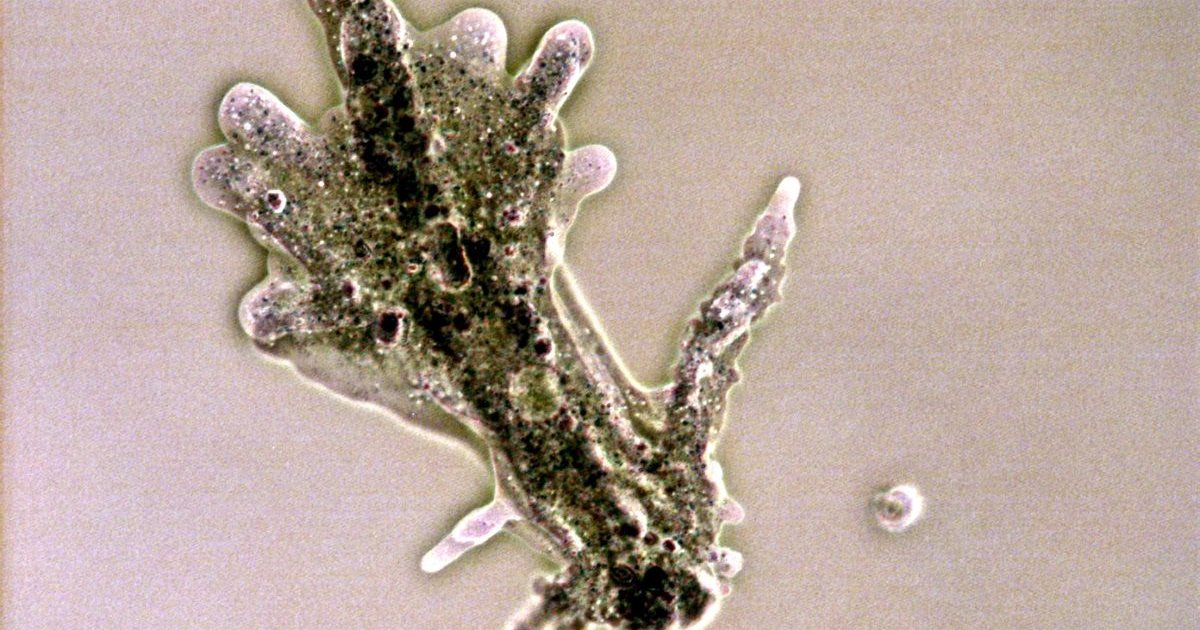Merida Zoo Brain-Eating Amoeba in Mexico: 6 Lakes Shut After Man's Death ...