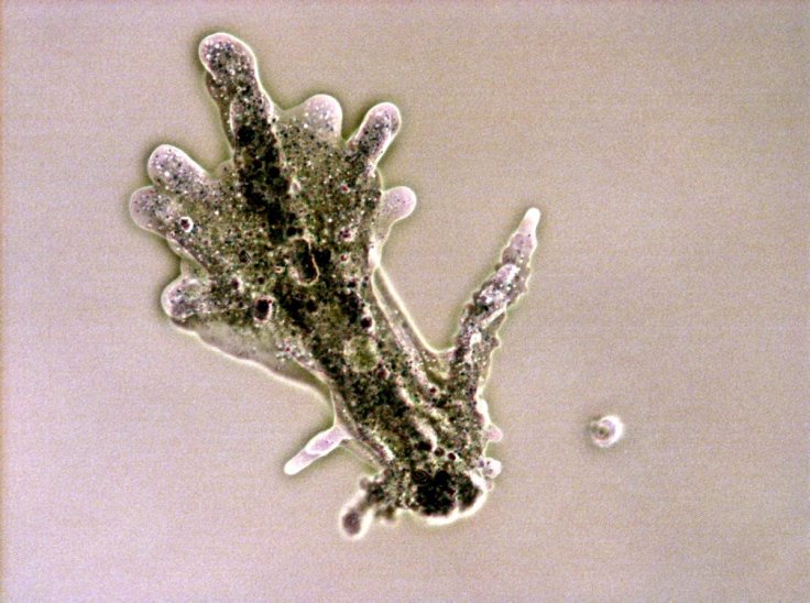 Brain-Eating Amoeba in Mexico: 6 Lakes Shut After Man's Death ...