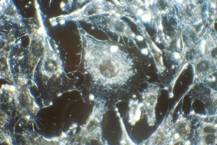 Cancer Cells Could Help Create the Drugs That Kill Them: Japan...